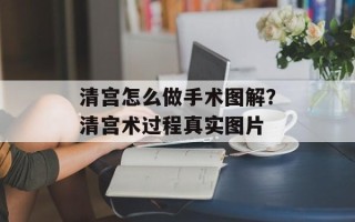 清宫怎么做手术图解？清宫术过程真实图片