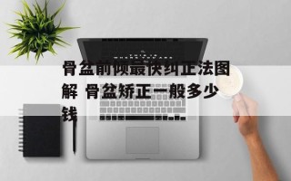 骨盆前倾最快纠正法图解 骨盆矫正一般多少钱