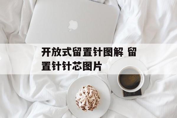 开放式留置针图解 留置针针芯图片-第1张图片-