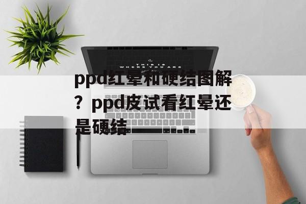 ppd红晕和硬结图解？ppd皮试看红晕还是硬结-第1张图片-