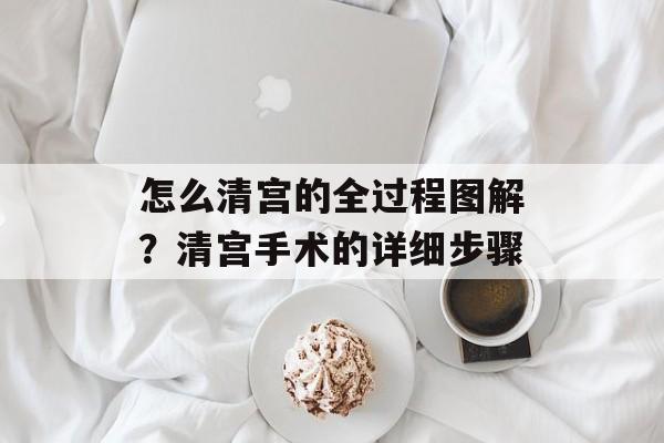 怎么清宫的全过程图解？清宫手术的详细步骤-第1张图片-